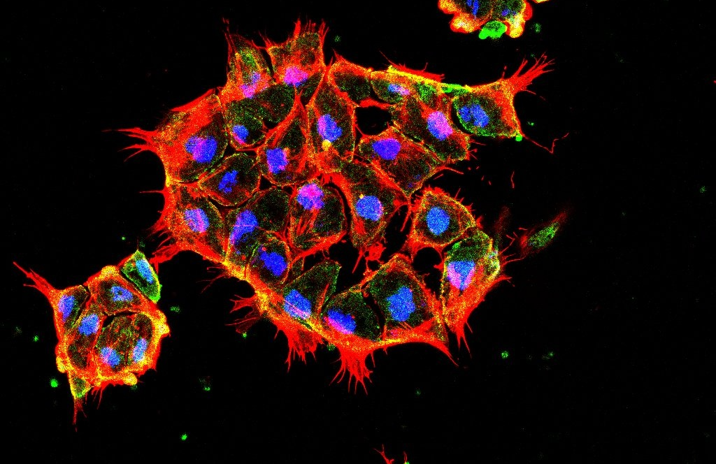 Charla virtual | Todos deberíamos ser anfibios: biologías colaborativas